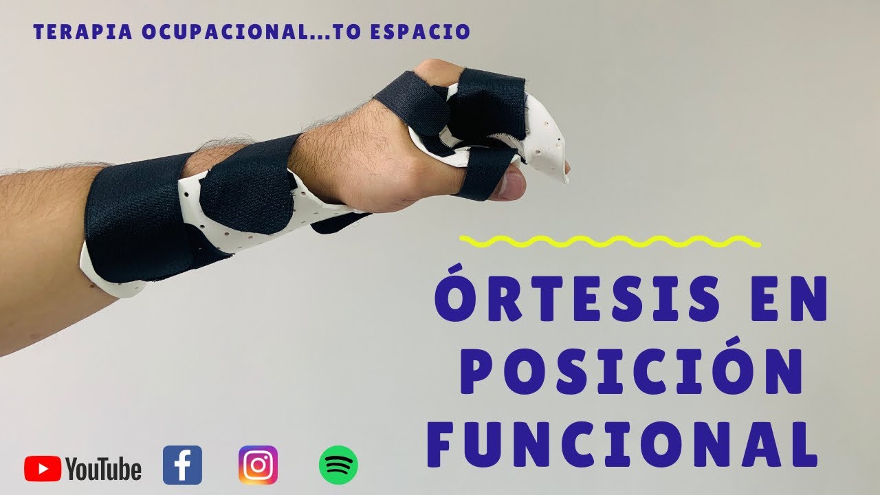 PASO A PASO CÓMO REALIZAR ORTESIS/FÉRULA DE MANO EN POSICIÓN FUNCIONAL