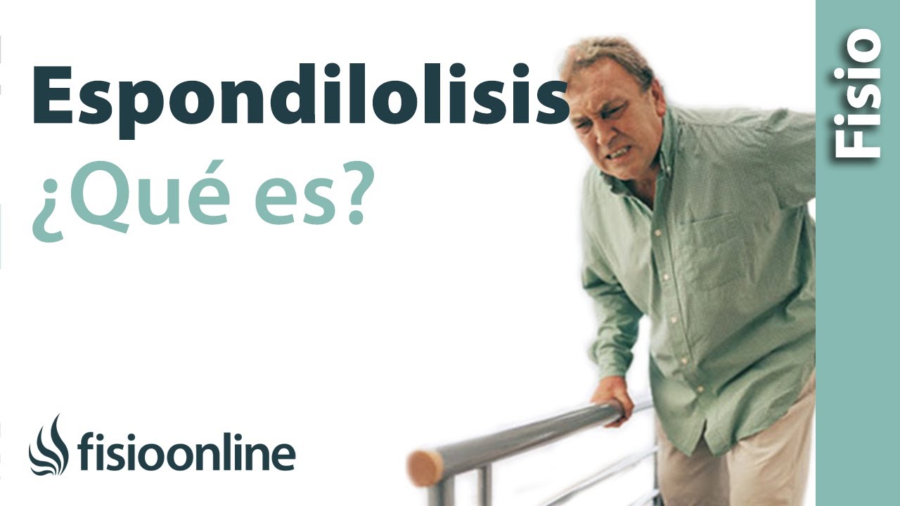 Espondilolisis - &iquest;Qu&eacute; es?