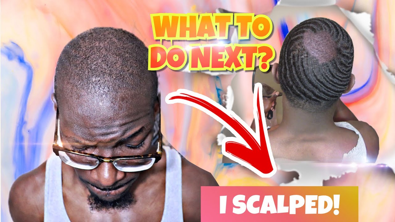 DON'T SCALP BEFORE WATCHING THIS!... WHAT TO DO AFTER SCALPING YOUR 360 WAVES!!!
