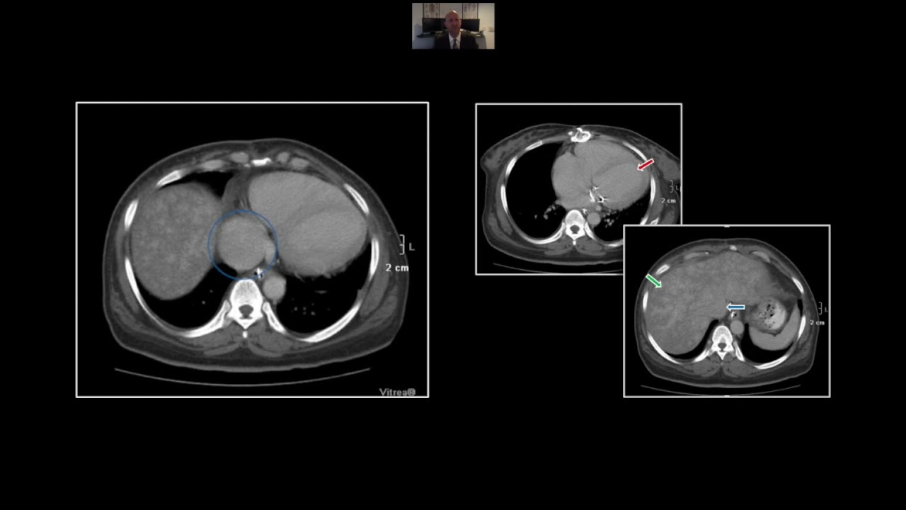 Hepatic Emergencies | Interesting Radiology Cases