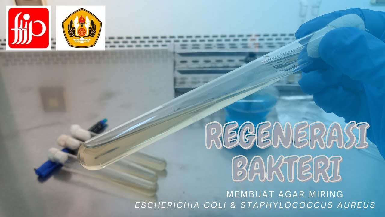 Regenerasi Bakteri/Menumbuhkan Bakteri/Agar Miring/Slant Agar/Escherichia coli