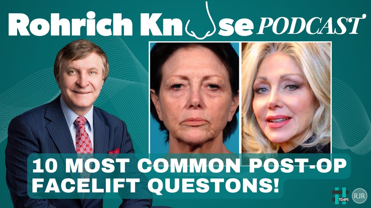 10 Common Post-op Facelift Questons!