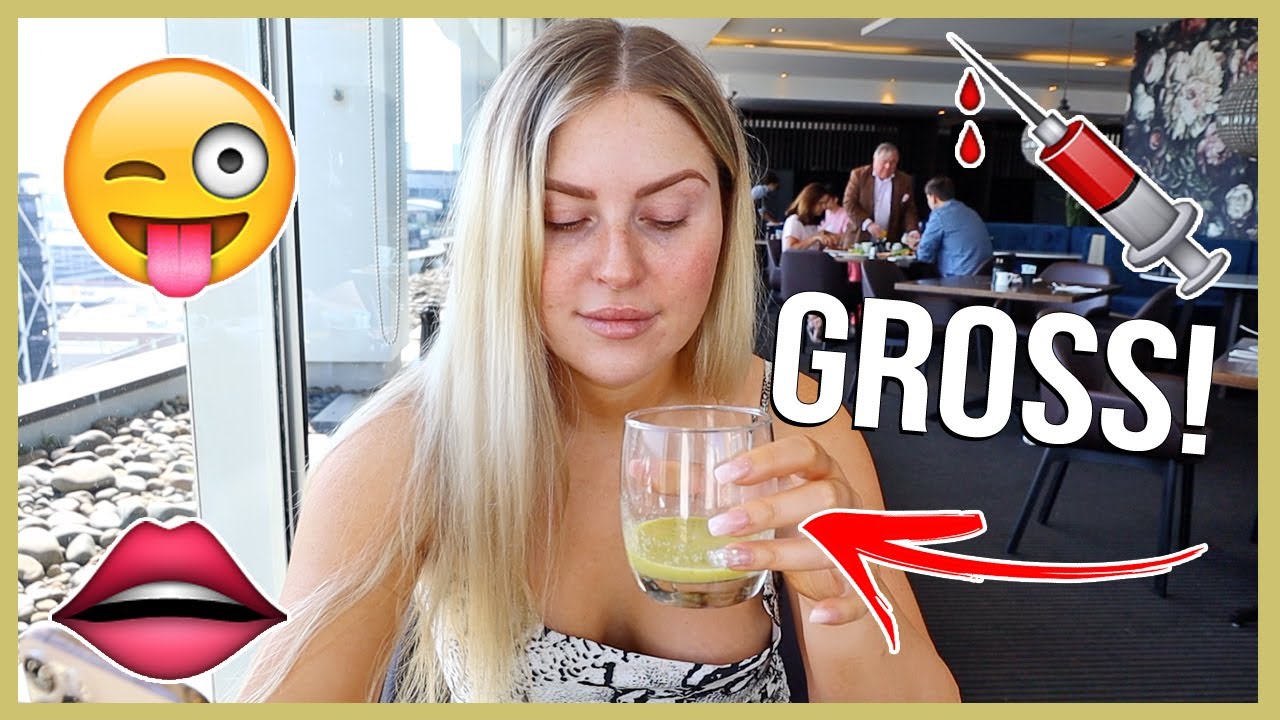 botox & filler update 💉 Vlog 648