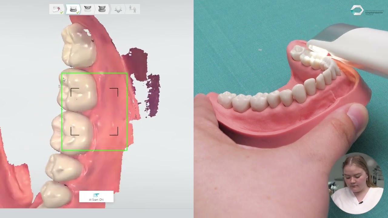 3D-skanning – status skann til tannteknikar