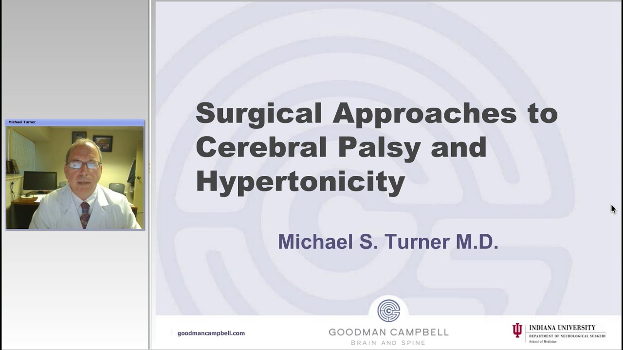 Patient Selection for Surgical Treatment of Spasticity (Preview)