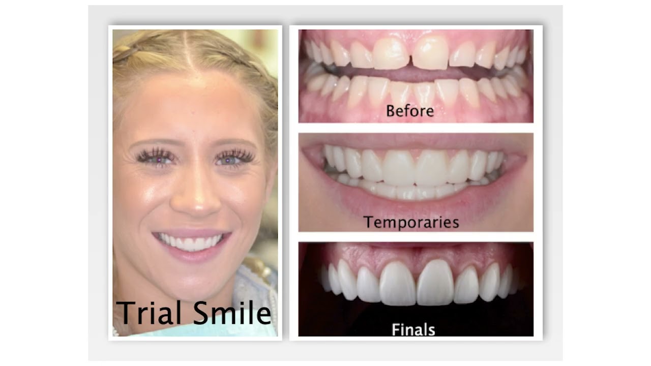 Planning a Smile Designs Consultation