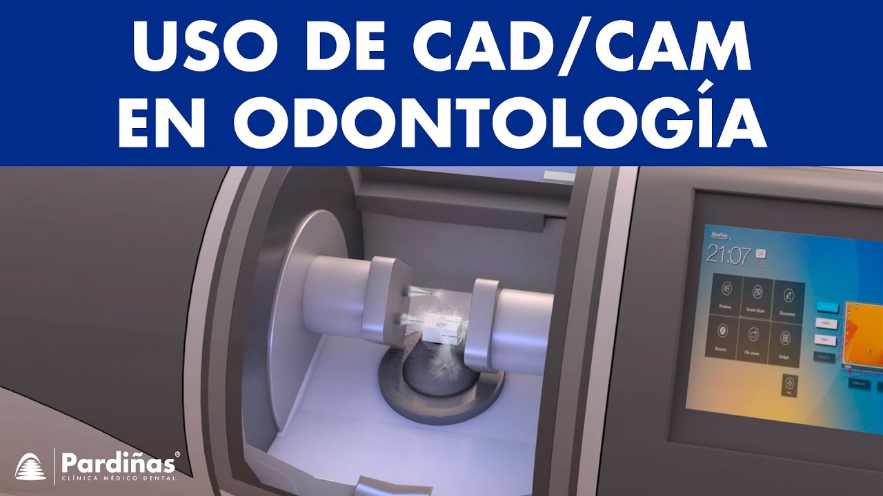 CAD/CAM dental - C&oacute;mo realizar PR&Oacute;TESIS DENTALES por ordenador &copy;