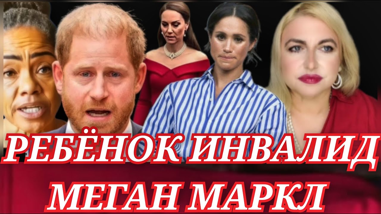 Отклонения ДЕТЕЙ Принца Гарри и Меган Маркл! ТЕСТЫ Кейт Миддлтон 