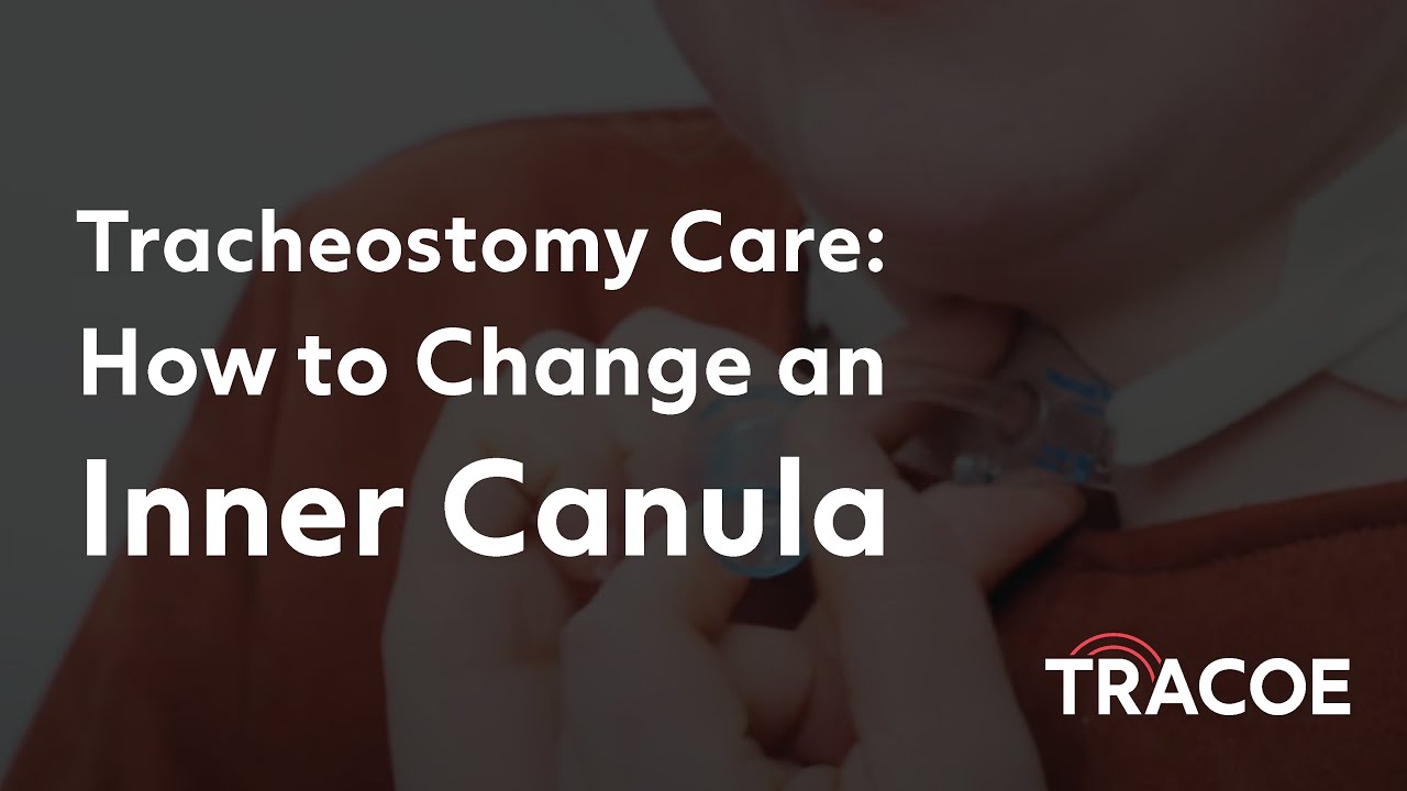Tracheostomy Care Step-by-Step: Changing an Inner Cannula - A Detailed Guide