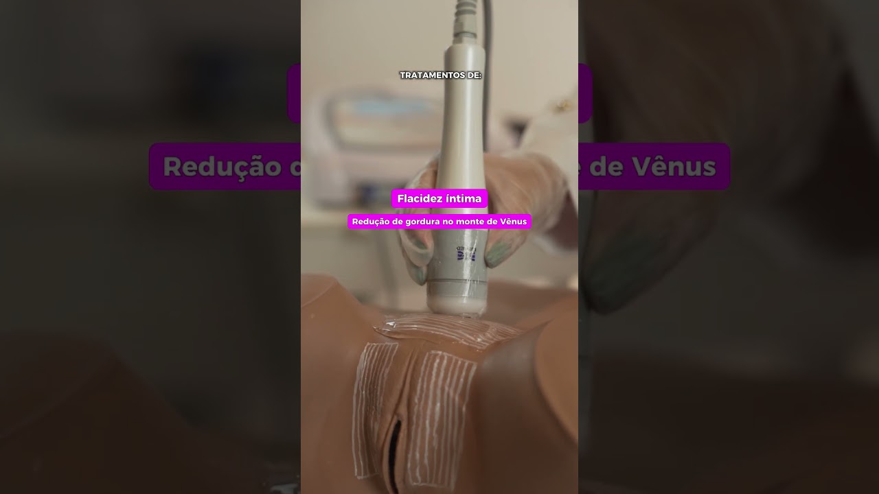 Est&eacute;tica intima com o Sonofocus da Ibramed