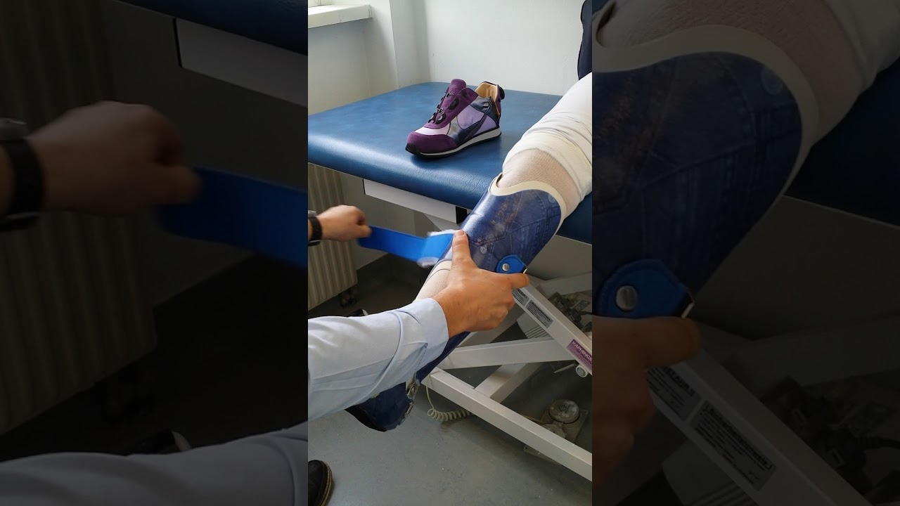 AFO-K3 (Hatchback-Orthese) Korrekt anlegen