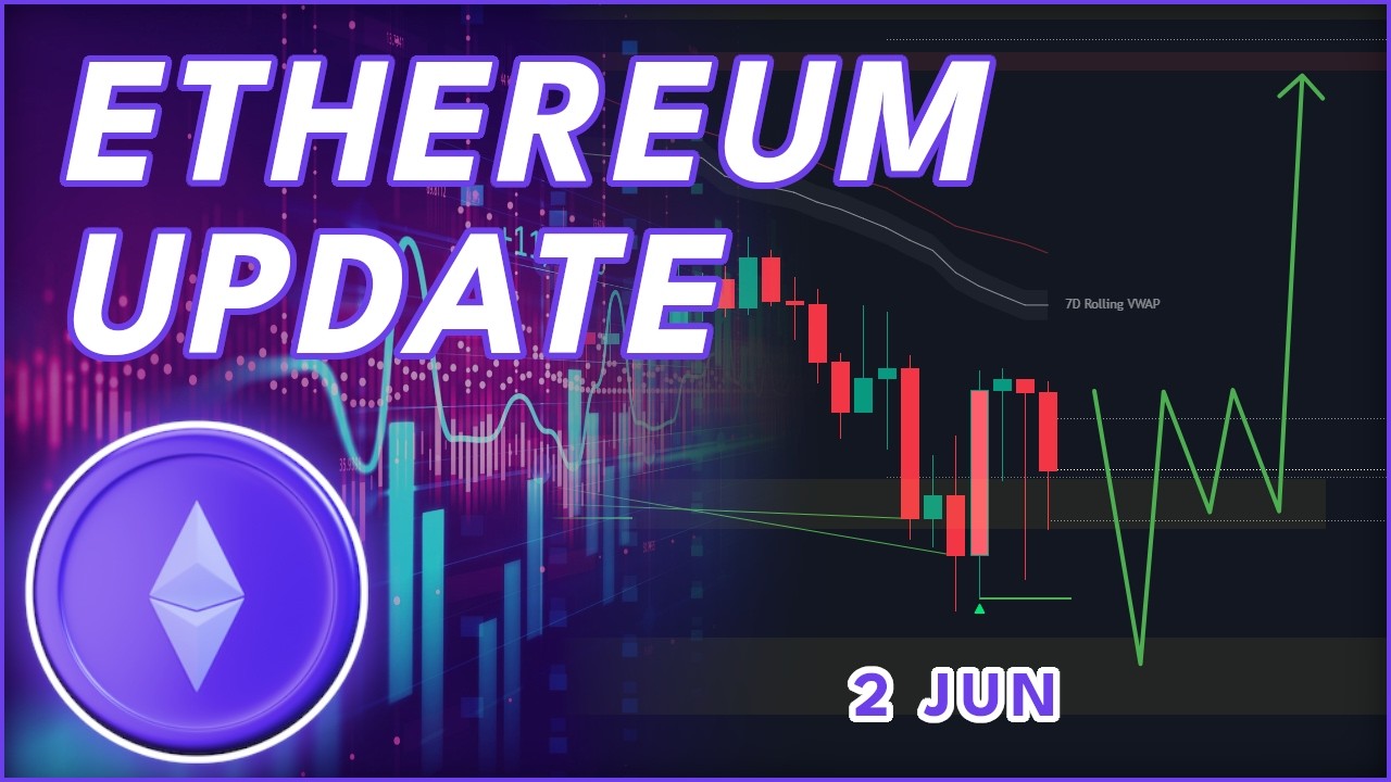 WHY ETH WILL SURPRISE EVERYONE! (Ethereum Update)