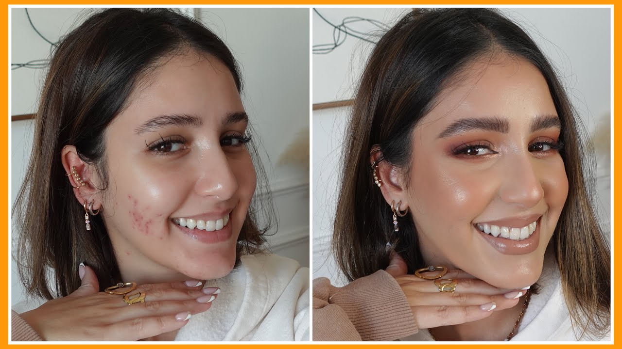 كيف تغطين حب الشباب بالمكياج | COUVRIR ACNÉ ET IMPERFECTION