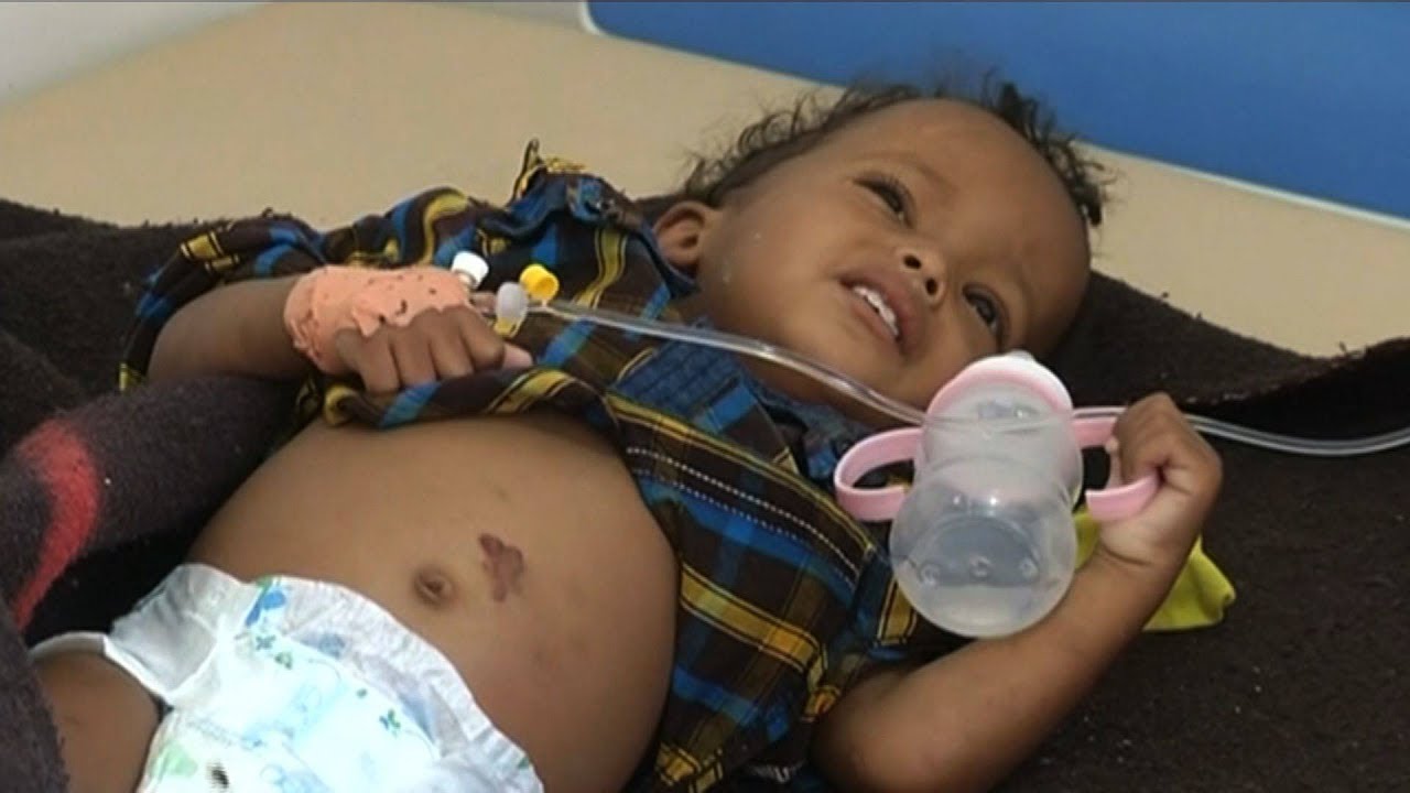 "A Forgotten Crisis": Yemen's Aid Workers Speak Out About the World's Worst Humanitarian Disaster