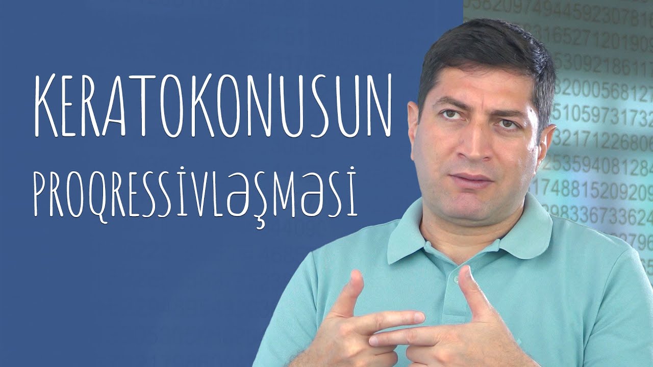 Keratokonusun proqressivləşməsi #RafadarXalilov #Keratokonus