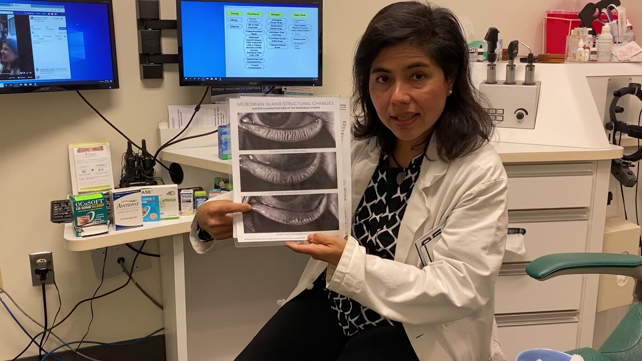 Dr. Cremers’ Updated Step Ladder for Dry Eye Disease/MGD/Eye Pain