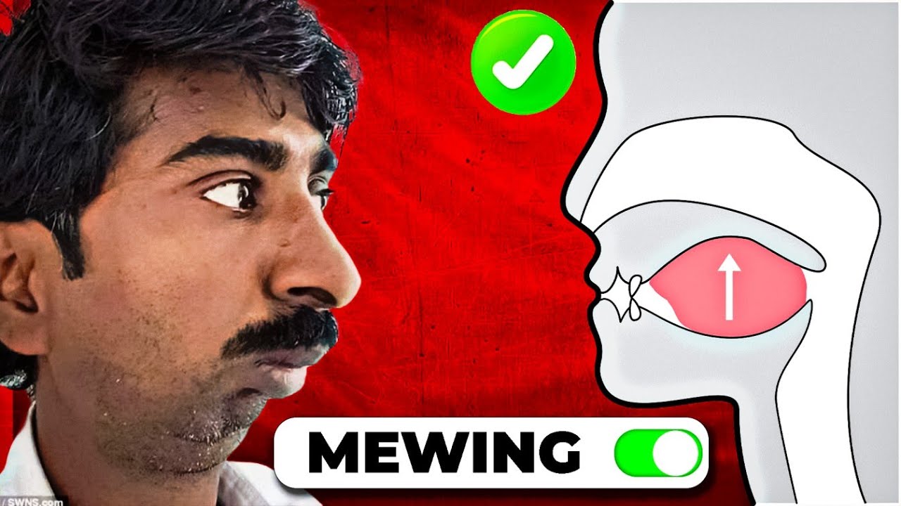 Mewing Kya Hota Hai?