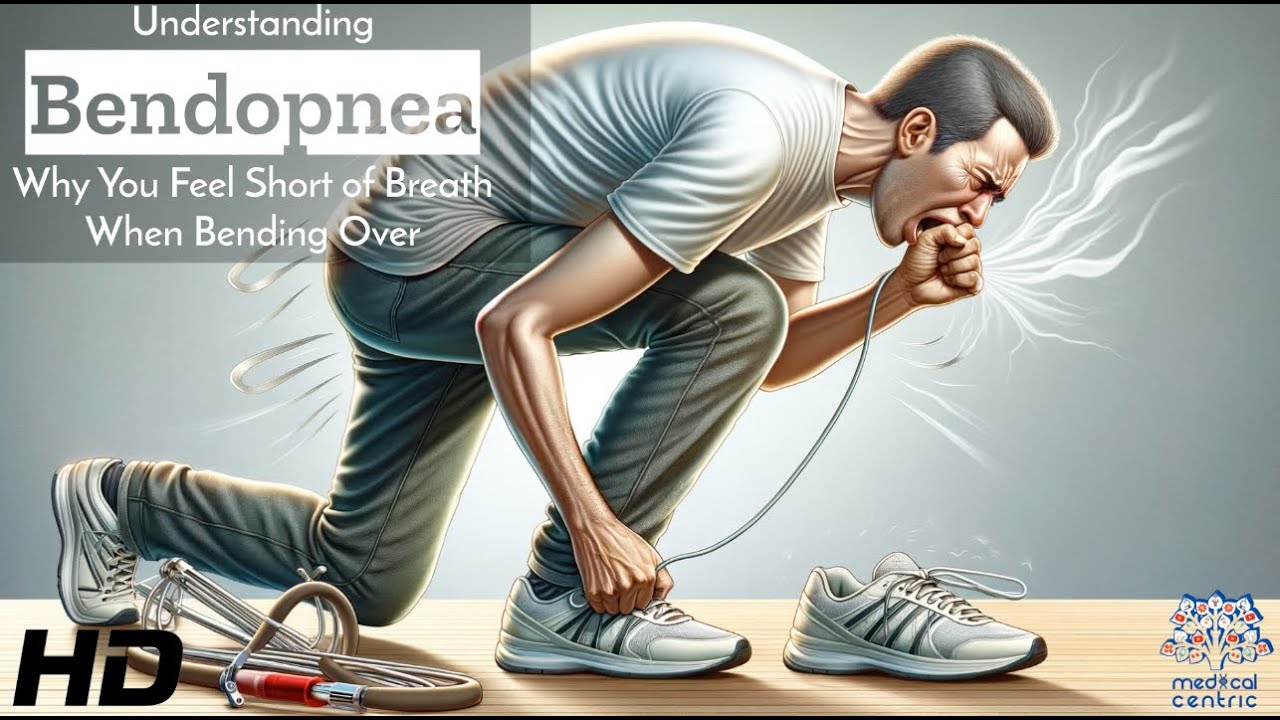 Bendopnea Unveiled: The Surprising Reason You're Short of Breath