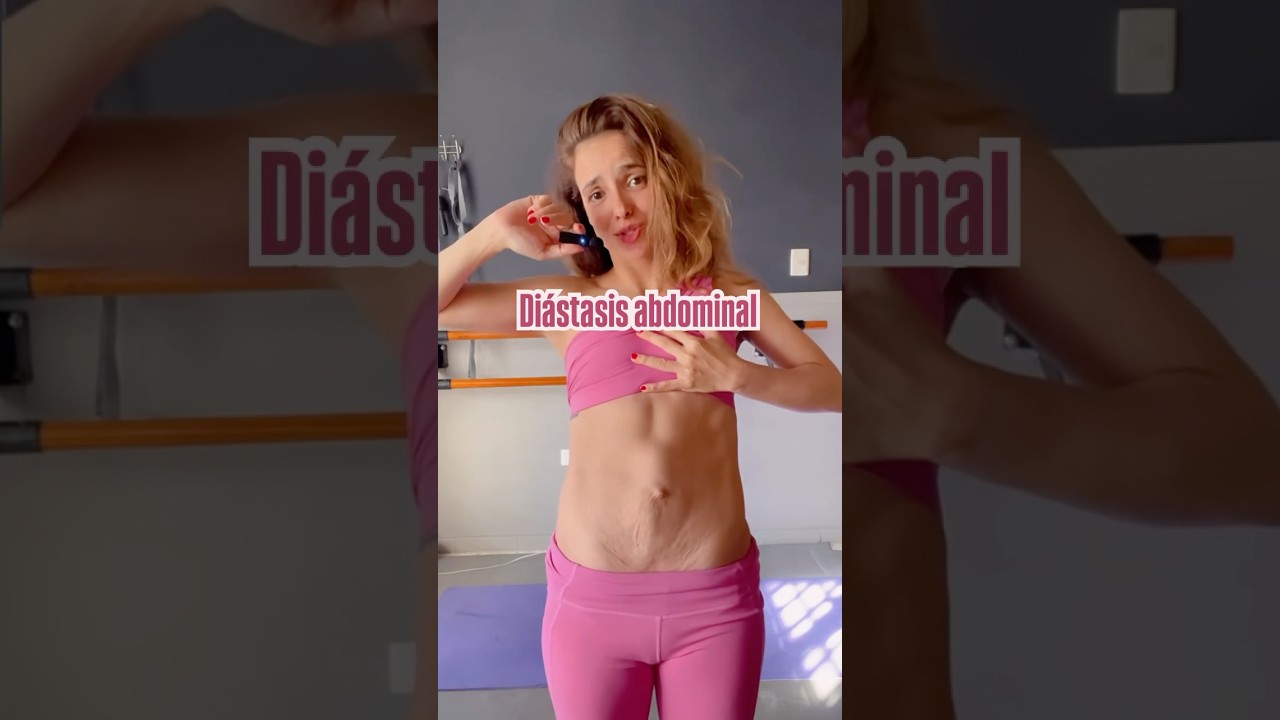 “Ejercicio efectivo para fortalecer la diástasis abdominal 💪✨ | ¡Recupera tu abdomen!”