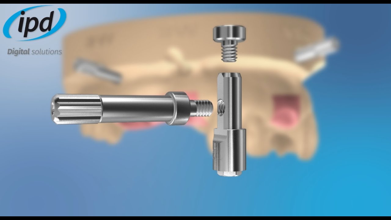 IPD - Digital Analog (English)