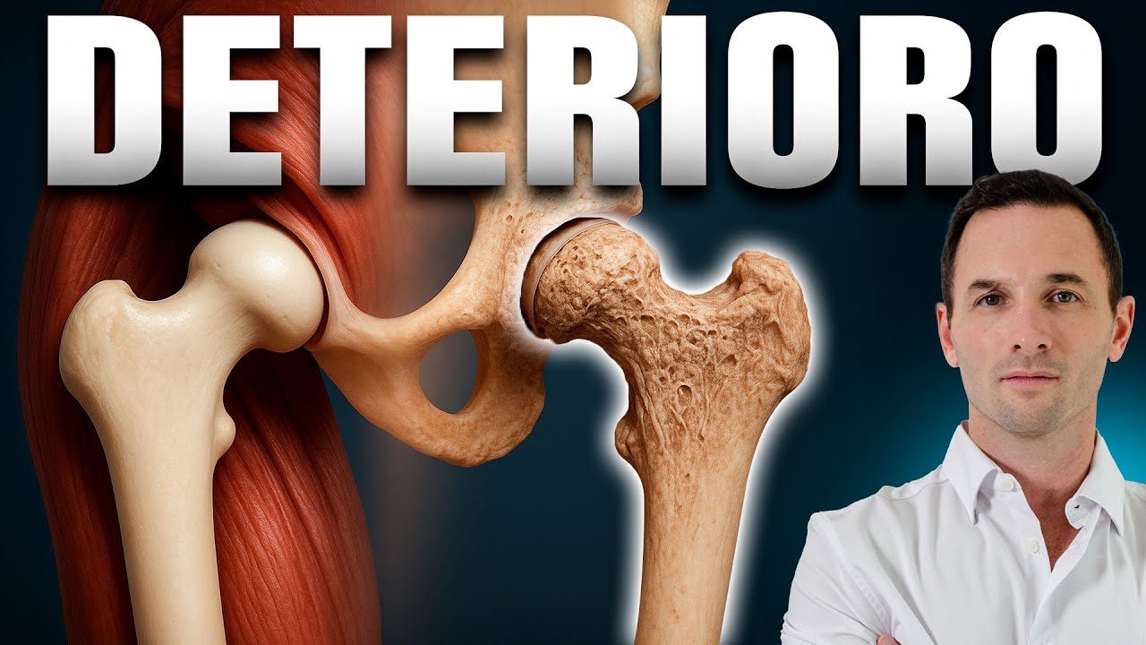 Tu dolor de CADERA te está Envejeciendo | Tratamientos NATURALES Sin Cirugía