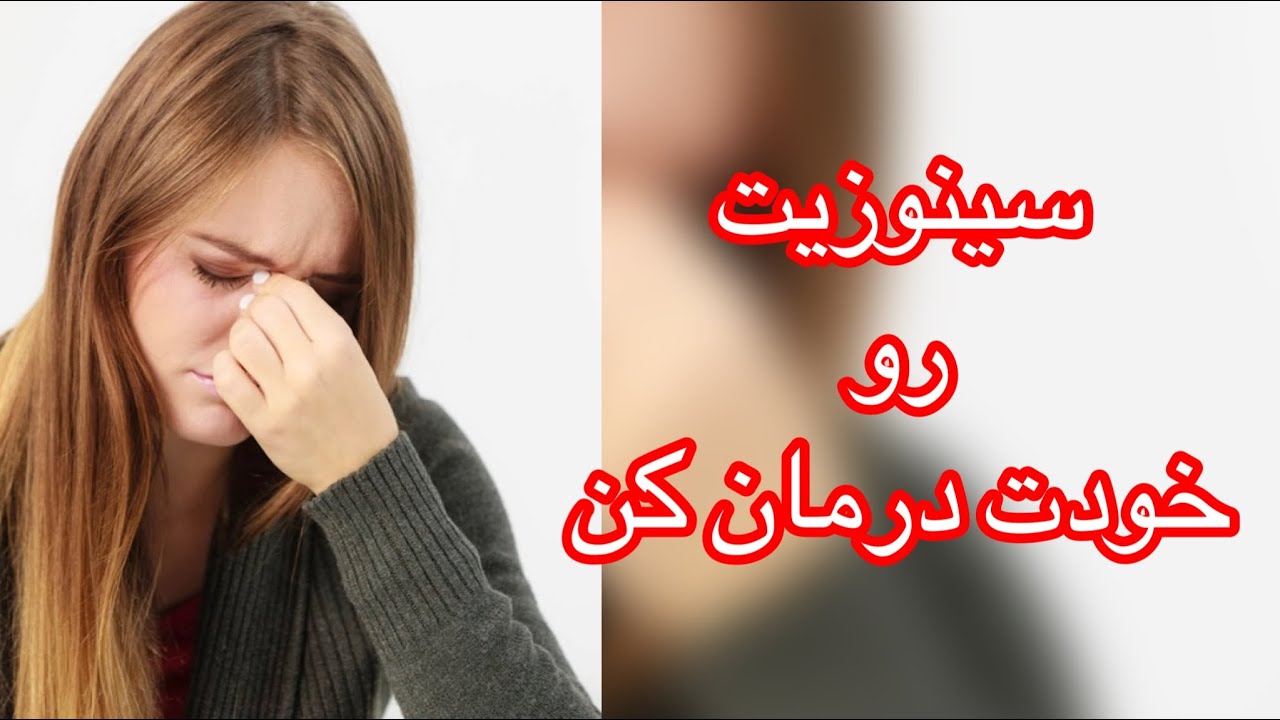 سینوزیت چیست و چه علائمی دارد ؟
درمان سینوزیت چگونه است؟