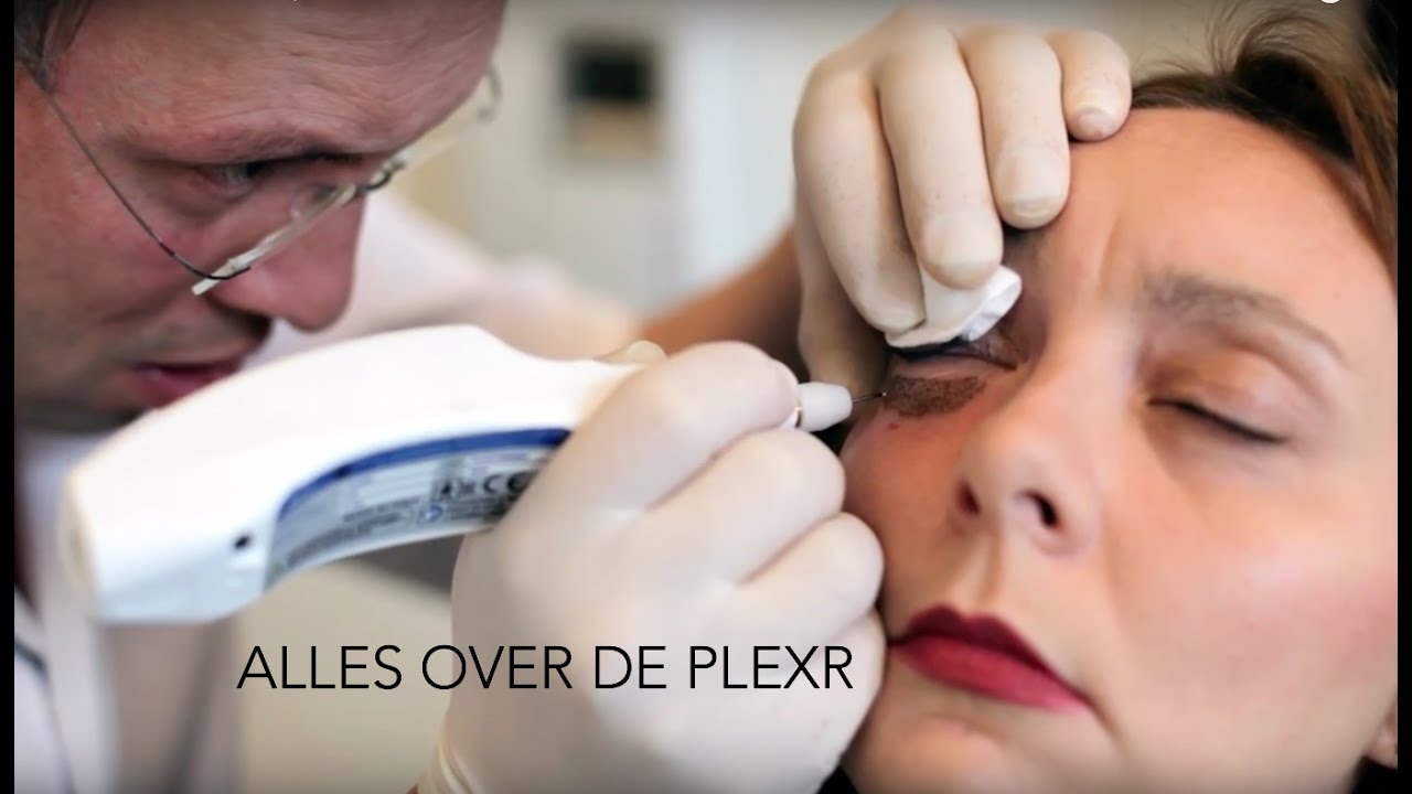 Alles over de PlexR | Furrow.nl