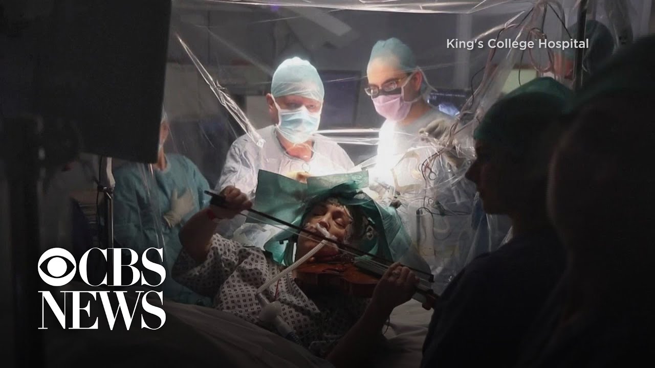 Woman plays violin to guide doctors during brain surgery