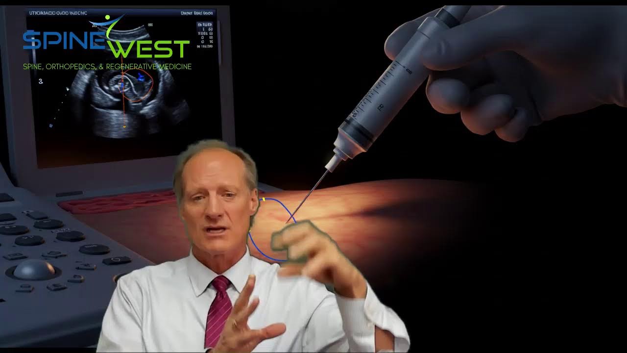 BMAC: Bone Marrow Aspirate Concentrate