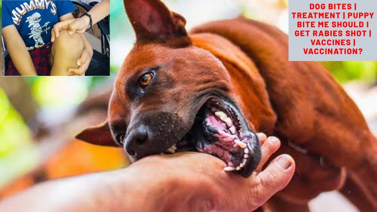 Dog Bites | Treatment | Puppy Bite me Should I get Rabies Shot | Vaccines | Vaccination? Bhola Shola