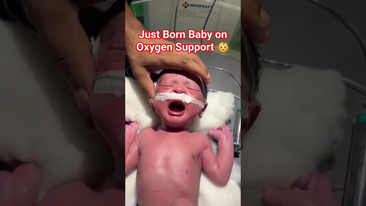 Just Born Baby on Oxygen Support 😇❤️🙏 #childcare #babycare #cutebaby #newborncare #newborn