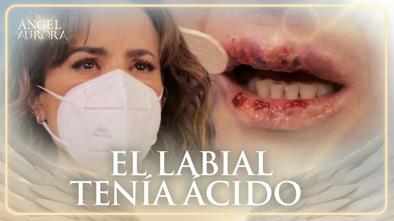 Jezabel pierde su preciada belleza | El Ángel de Aurora 2/4 | Capítulo 84