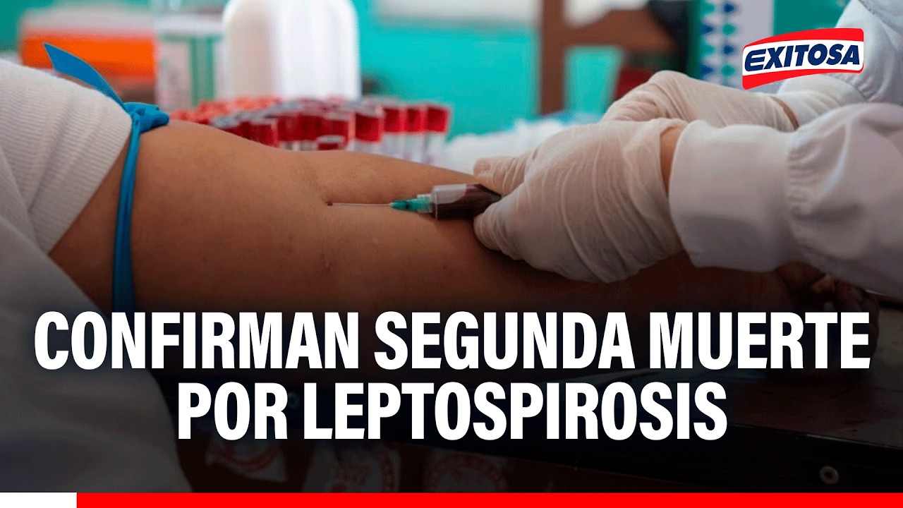 🔴🔵 Confirman segunda muerte por Leptospirosis en Tumbes