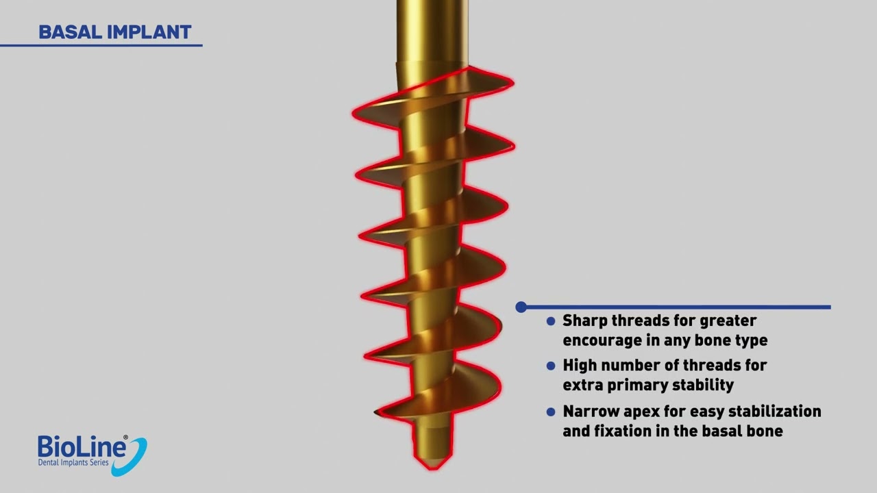 The All New BioLine Single Piece Implant System !