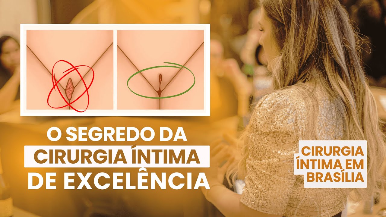 O SEGREDO DA CIRURGIA ÍNTIMA DE EXCELÊNCIA - Dra. Thalia Maia - Ginecologista - Brasília