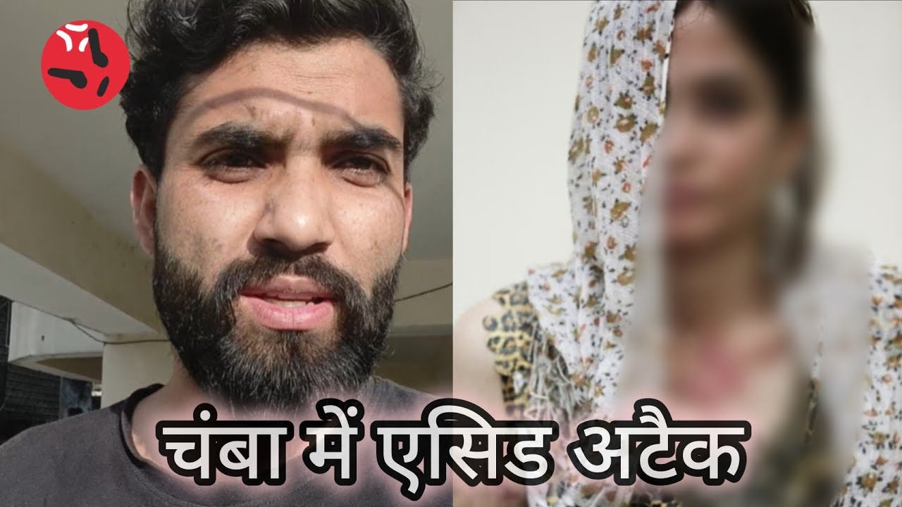 Untold story 💔 Chamba mai acid attack 😳