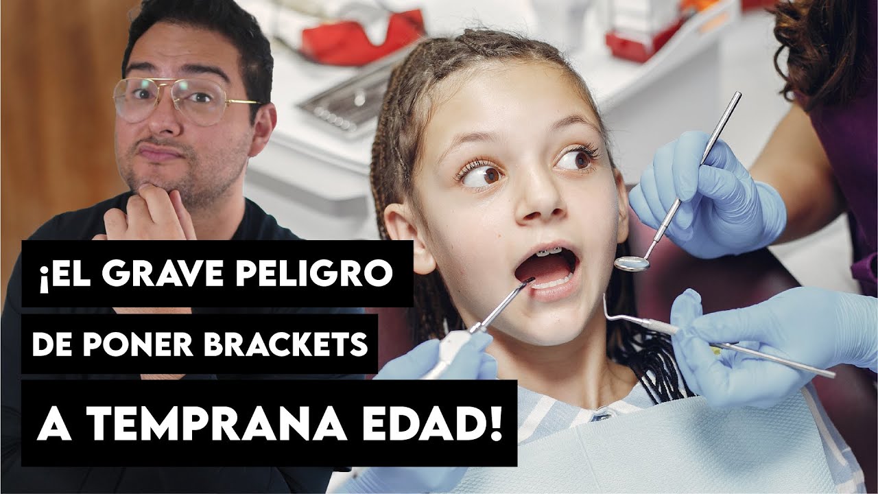 &iexcl;EL GRAVE PELIGRO DE PONERTE BRACKETS A LOS 11 A&Ntilde;OS! ORTODONCIA INFANTIL