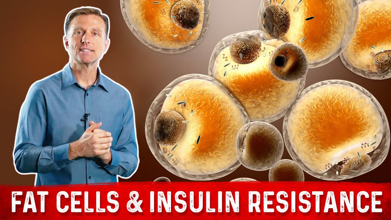 Does Losing Weight Reduce Insulin Resistance? &ndash; Dr.Berg