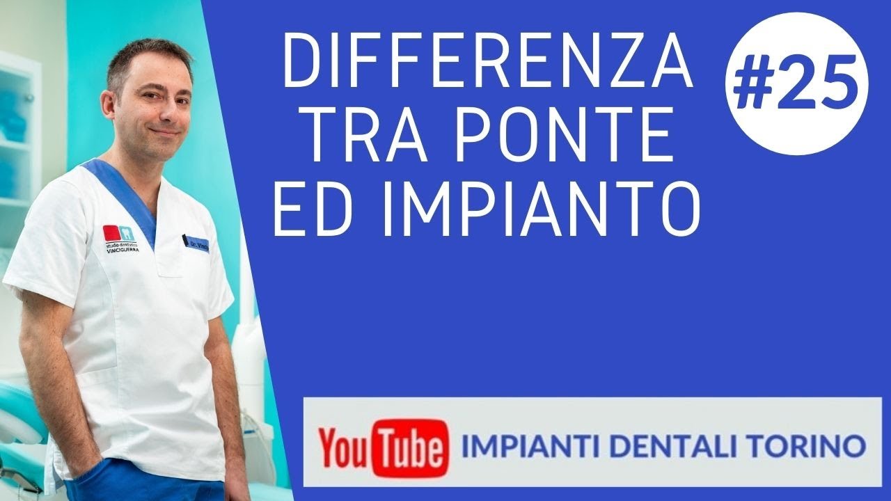 DIFFERENZE TRA IMPIANTO E PONTE   IMPIANTI DENTALI TORINO