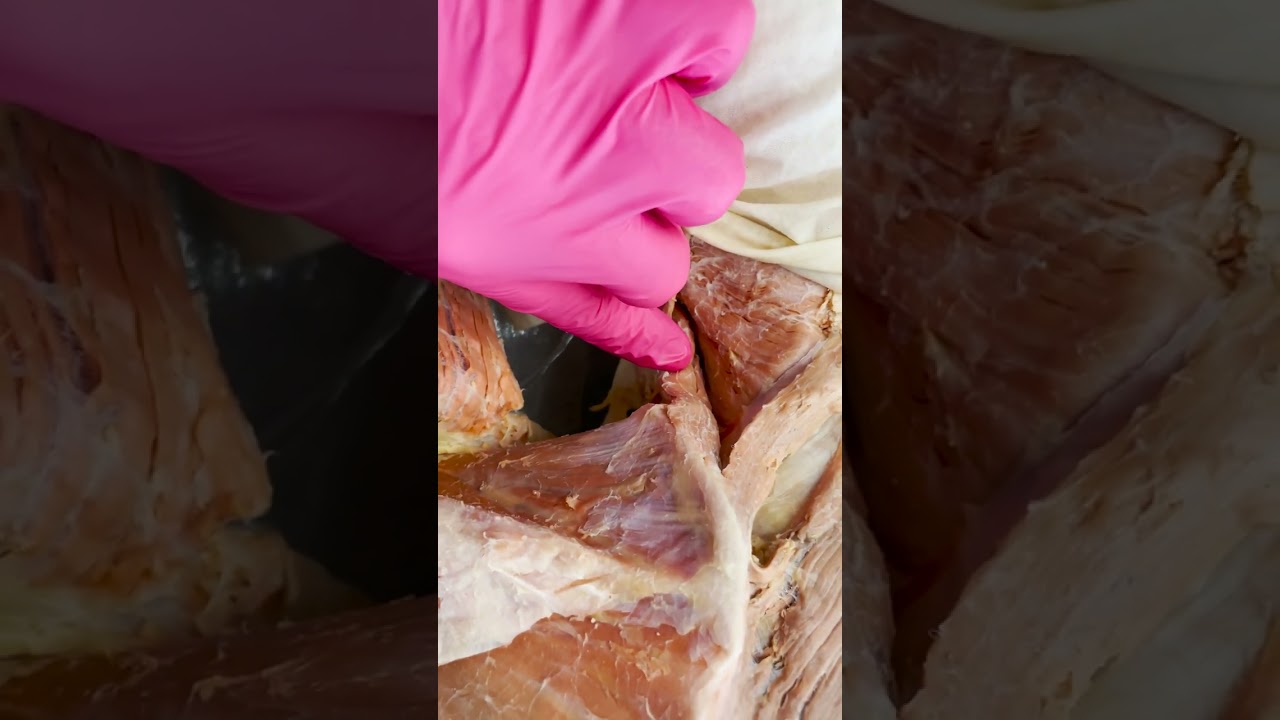 What Makes the Scapula so Unique
