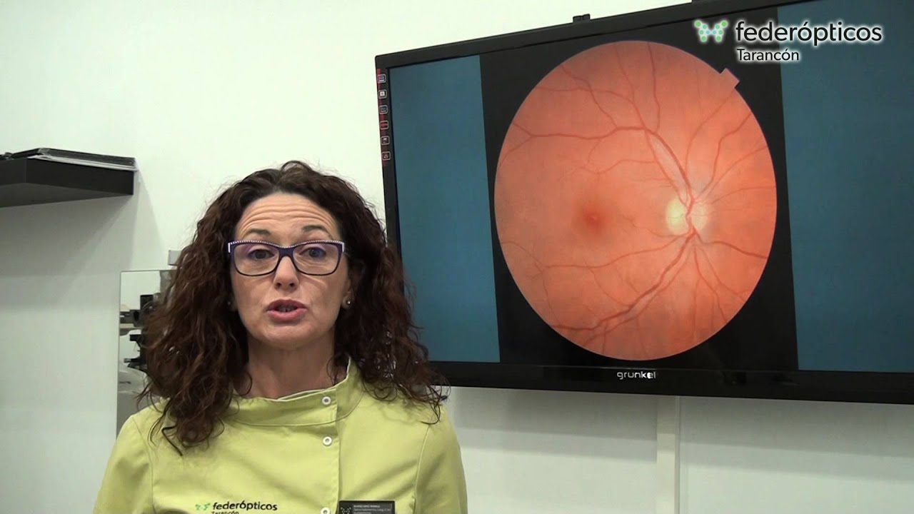 Video-blog &iquest;Qu&eacute; es una Retinograf&iacute;a?