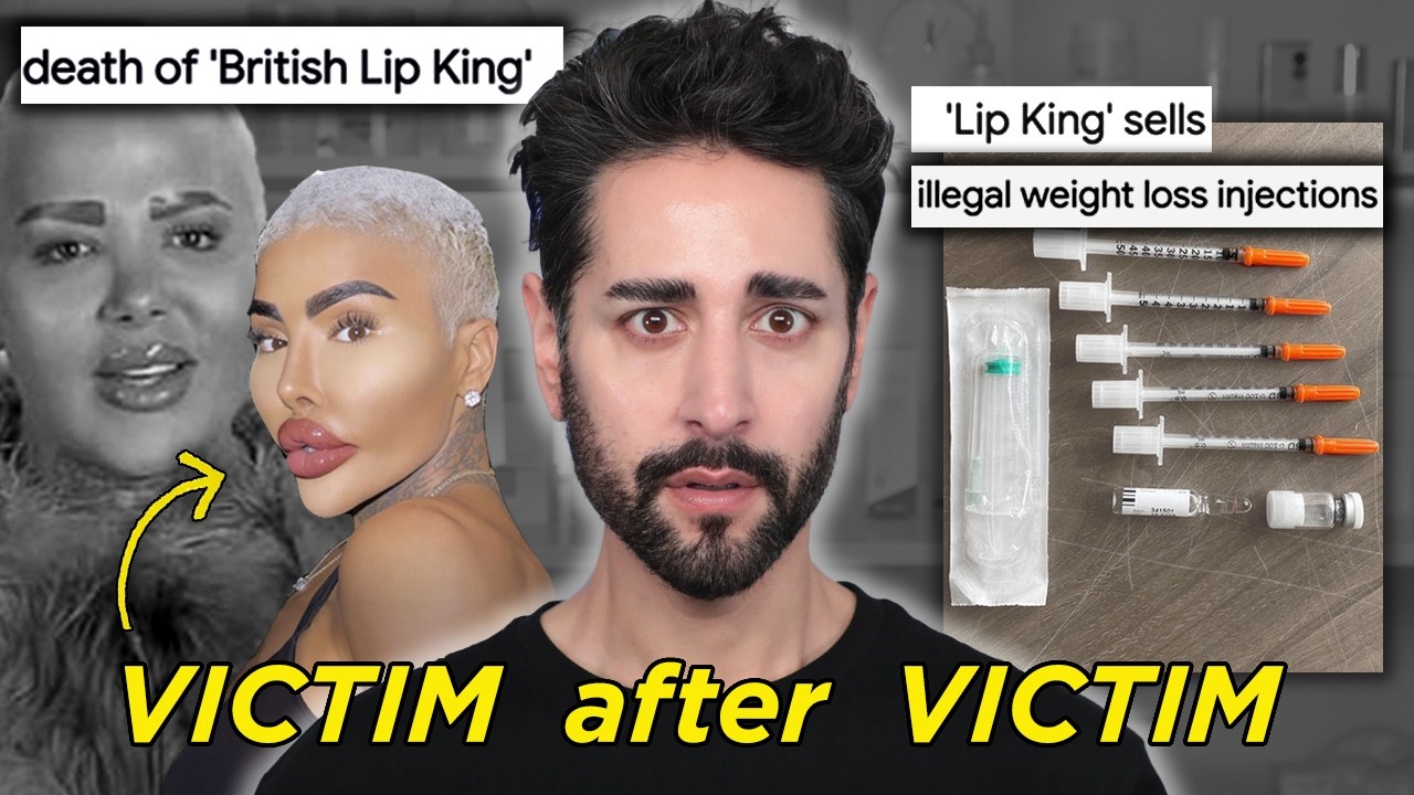 The Lip King: Fame, Fillers, and FATAL Cosmetic Procedures