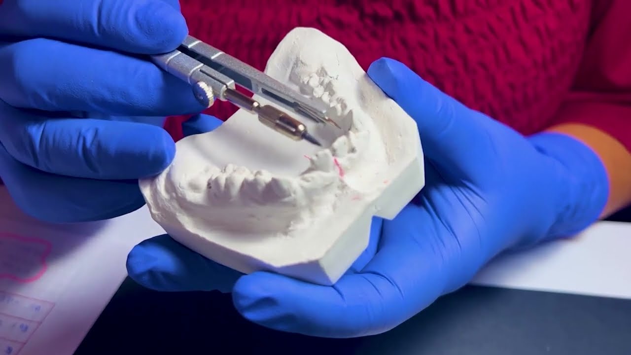 ANALISIS DEL ESPACIO DE DENTICION MIXTA DE TANAKA Y JOHNSTON - OD. ADRIANA CHÁVEZ