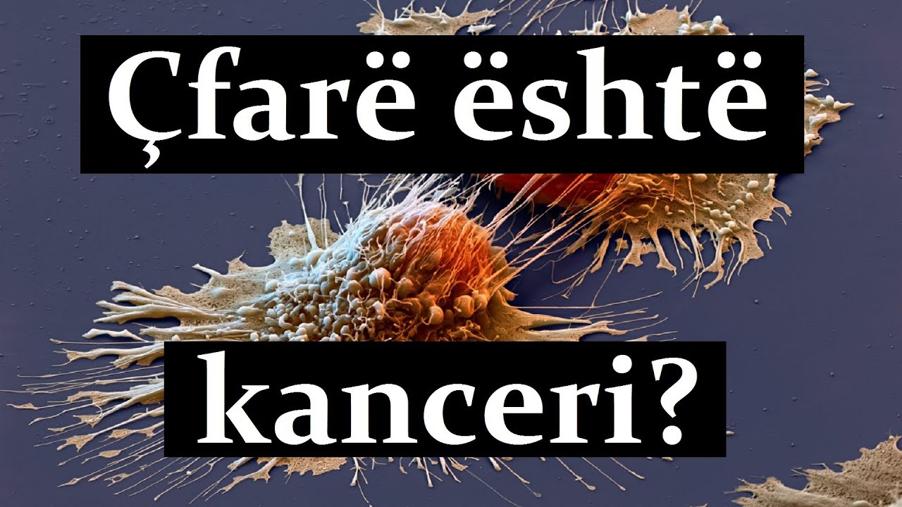 Çfarë është kanceri?