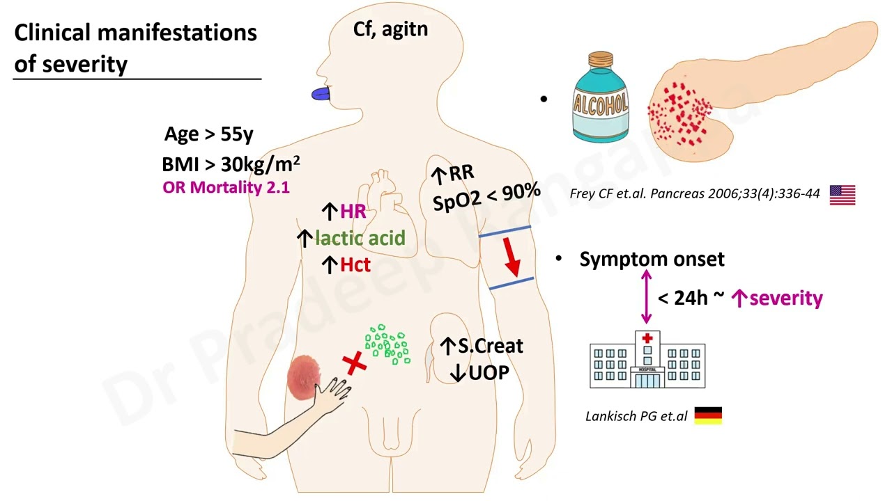 Acute Pancreatitis Scoring_Overview_Dr Pradeep Rangappa