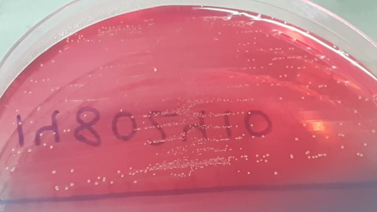 Enterococcus gallinarum growth on CLED Agar | Uropathogen