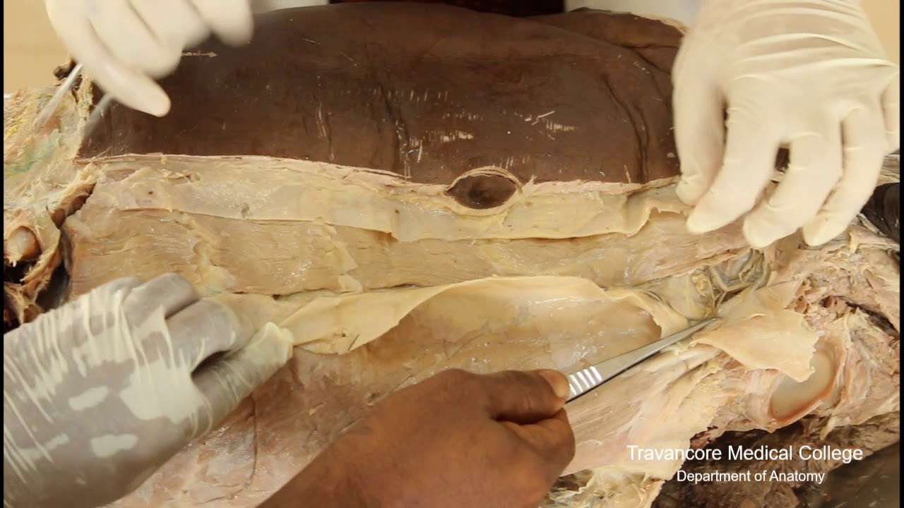 Part-2: Abdominal wall