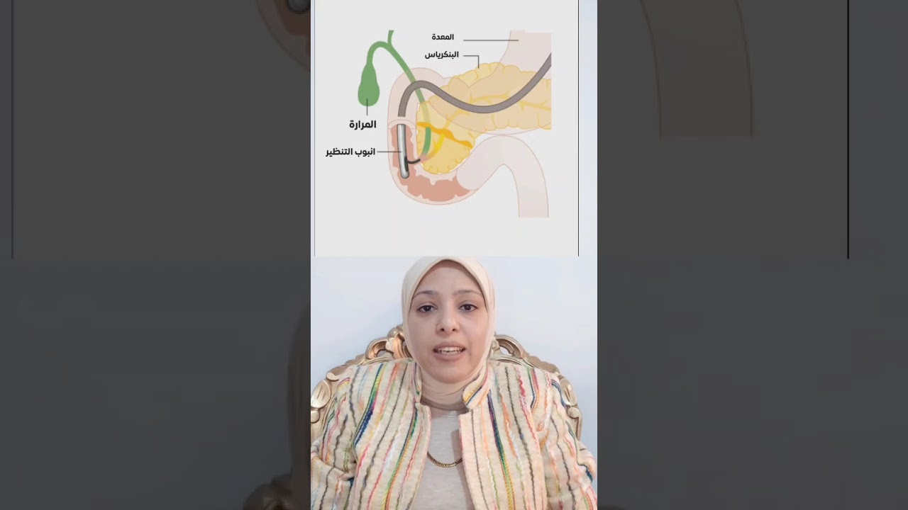 ERCP منظار القنوات المرارية وقناه البنكرياس