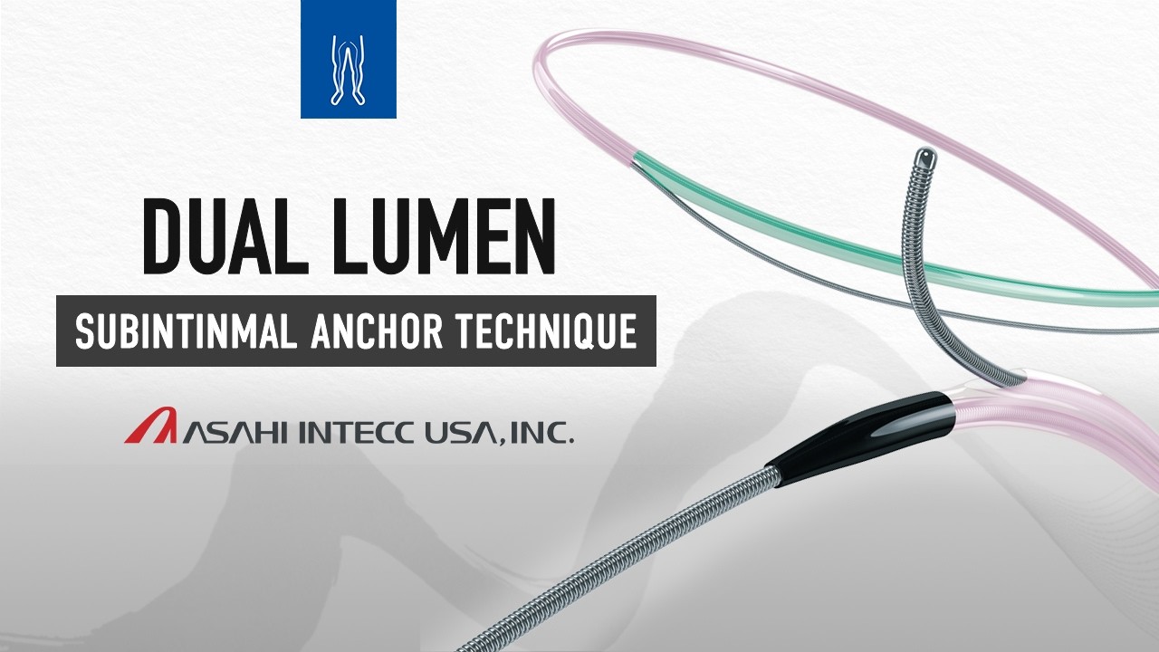 Subintimal Anchor Technique: Dual-Lumen Catheter Tutorial