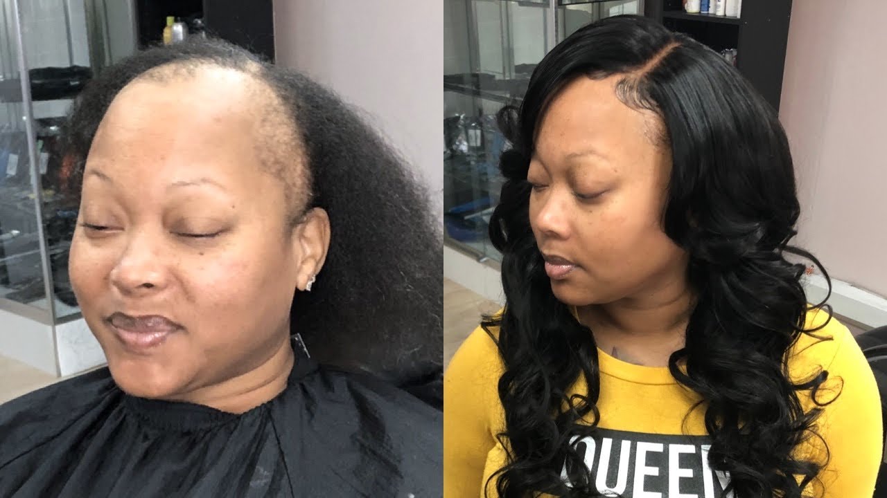 GLUELESS CLOSURE SEW IN | ALOPECIA CLIENT (Bouncy Layered Curls Tutorial )
